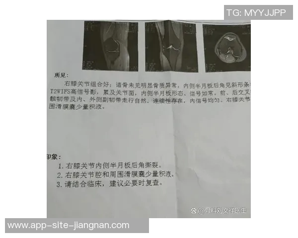 小卡34岁迎生涯首个50分表现ACL部分撕裂与半月板损伤影响膝盖健康